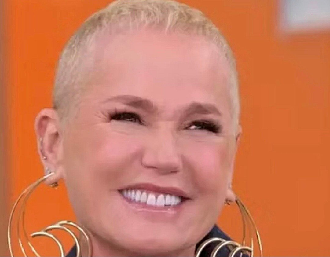 Xuxa aparece com fios novos após transplante capilar